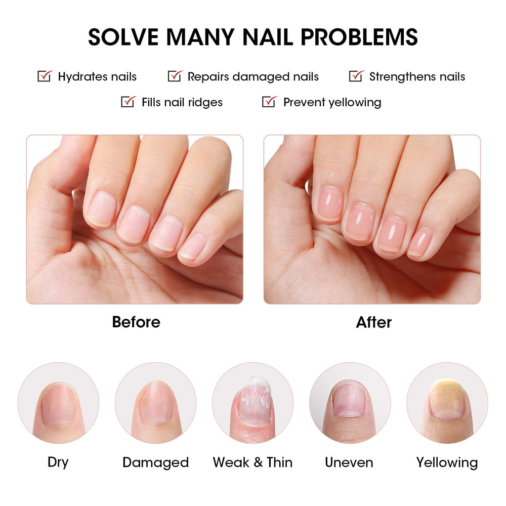 GELLEN self-leveling formula image aids bubble-free ridge filling.