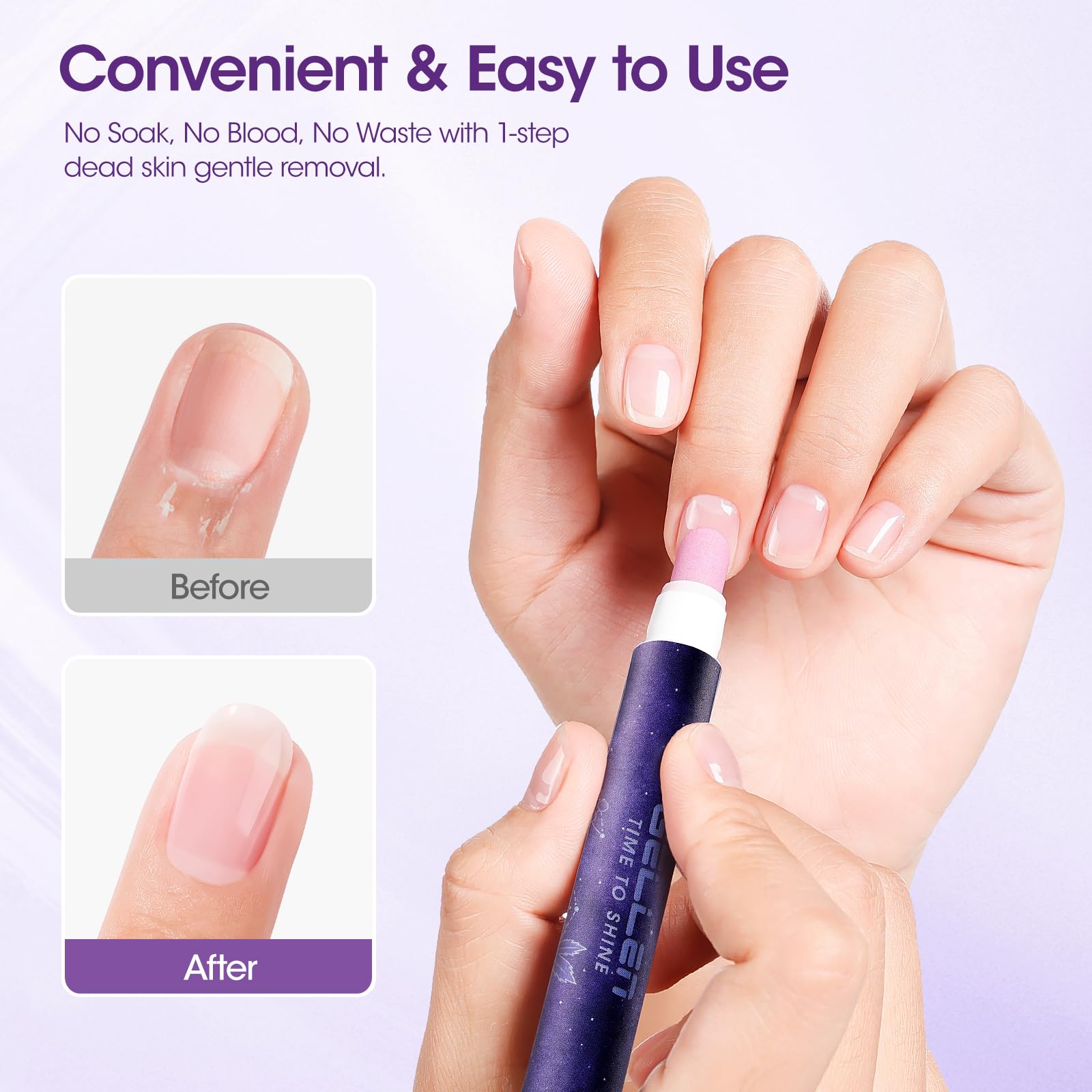 GELLEN smooth edges and reduced rough cuticles during use.