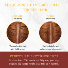 Gemächlich Zu Hause Biotin Rosemary scalp serum nourishes roots.