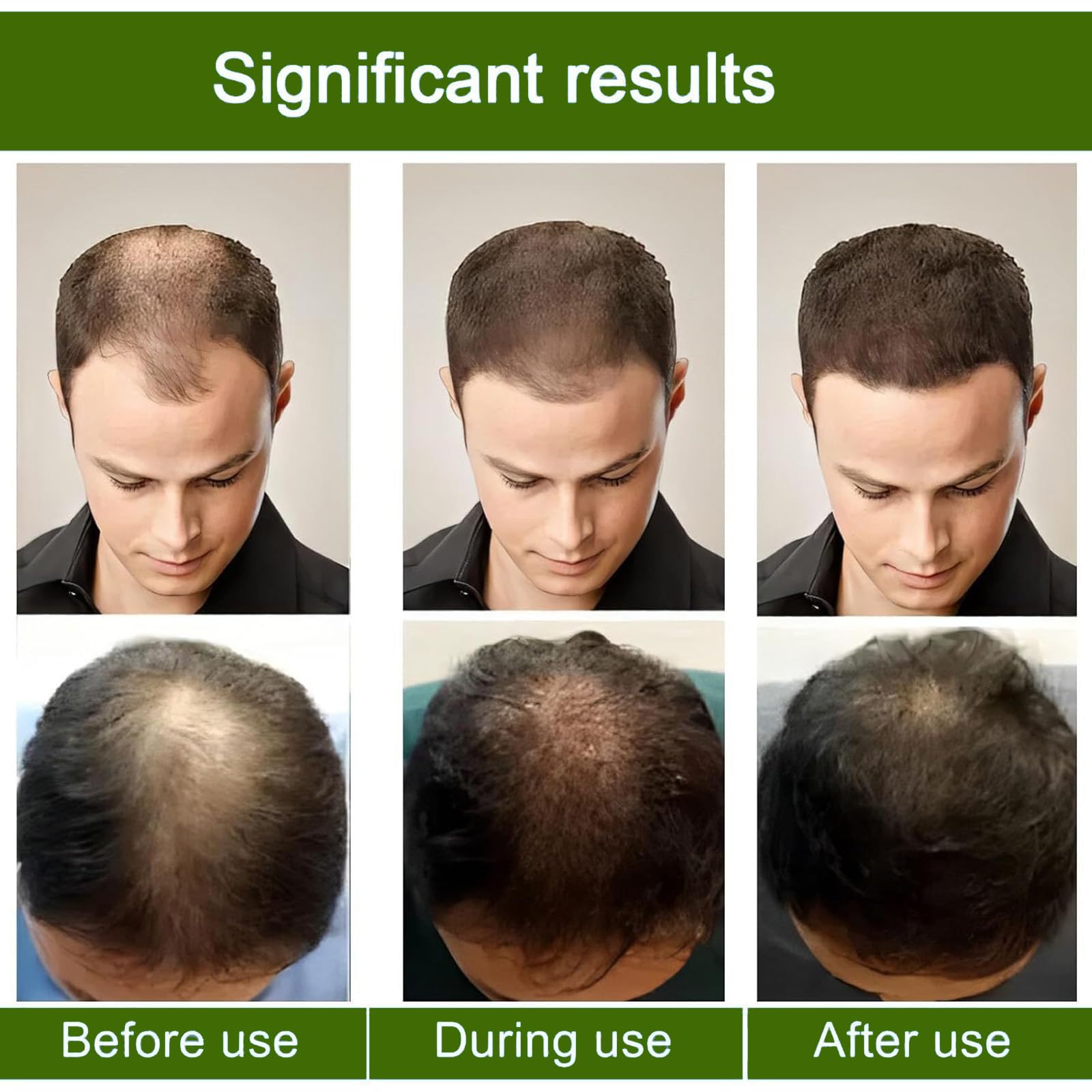 Generic Alpha Infuse ginseng extract, nutrient-rich blend for healthier scalp environment