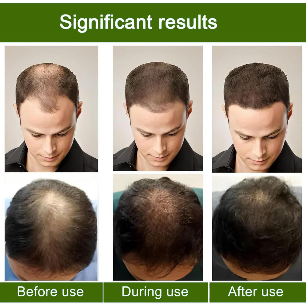 Generic Alpha Infuse ginseng extract, nutrient-rich blend for healthier scalp environment