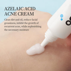 Generic Azelaic Acid Cream tube close-up for easy application