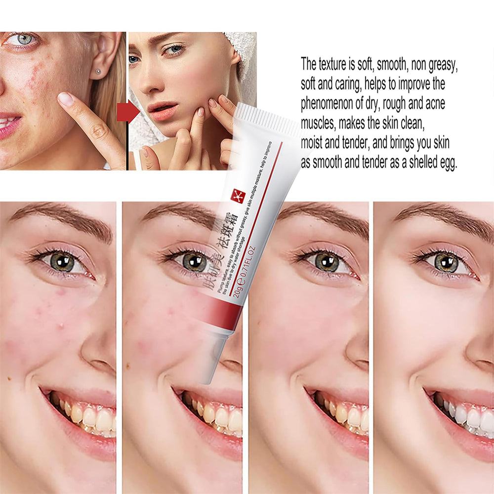 Generic Dark Spot Cream Face jar shows compact 20g container