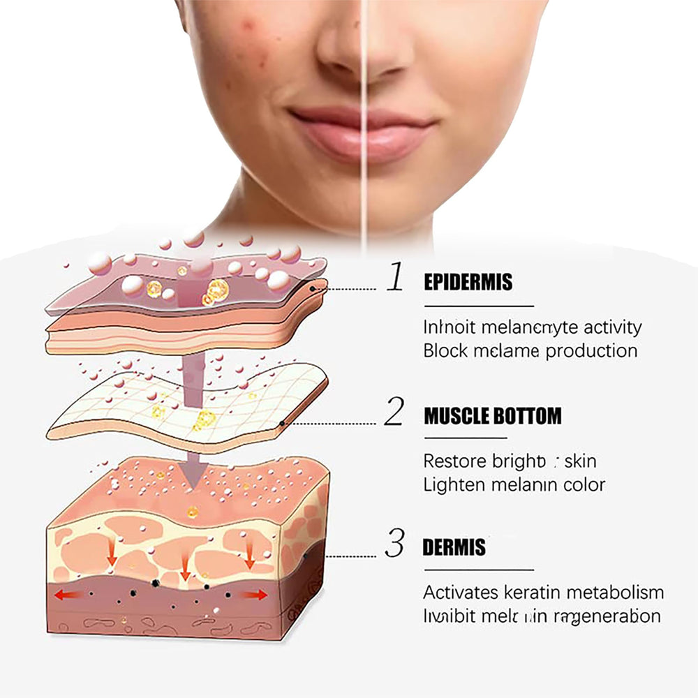 Generic Dark Spot Cream Face tone image hints at even complexion