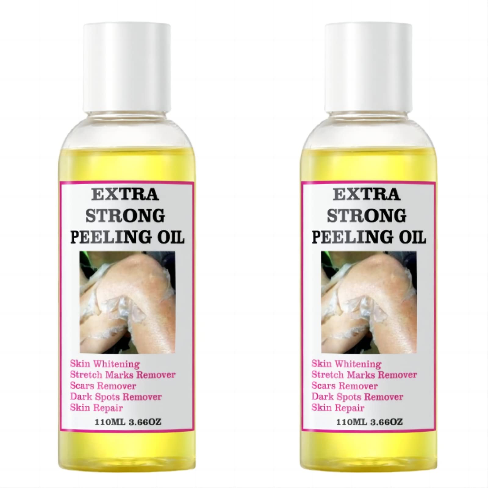 Generic Extra Strong Peeling Oil bottle ready for at-home exfoliation