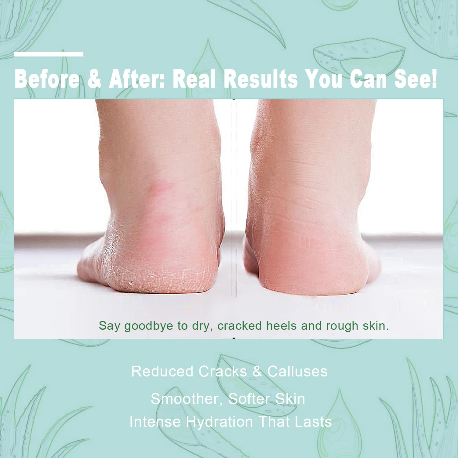 Generic Fragrance-free unscented foot cream suitable for sensitive skin