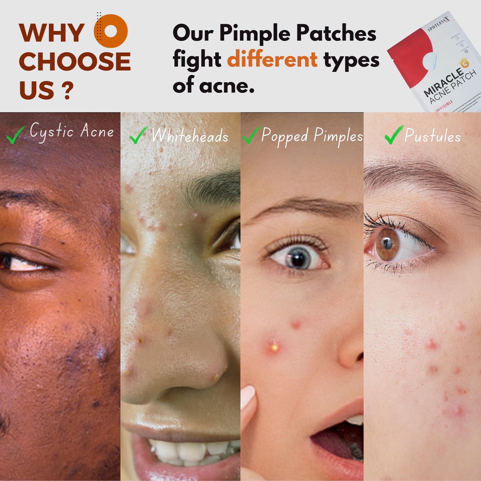 Generic Hypoallergenic Acne Patch label emphasizes skin-friendly, drug-free care.