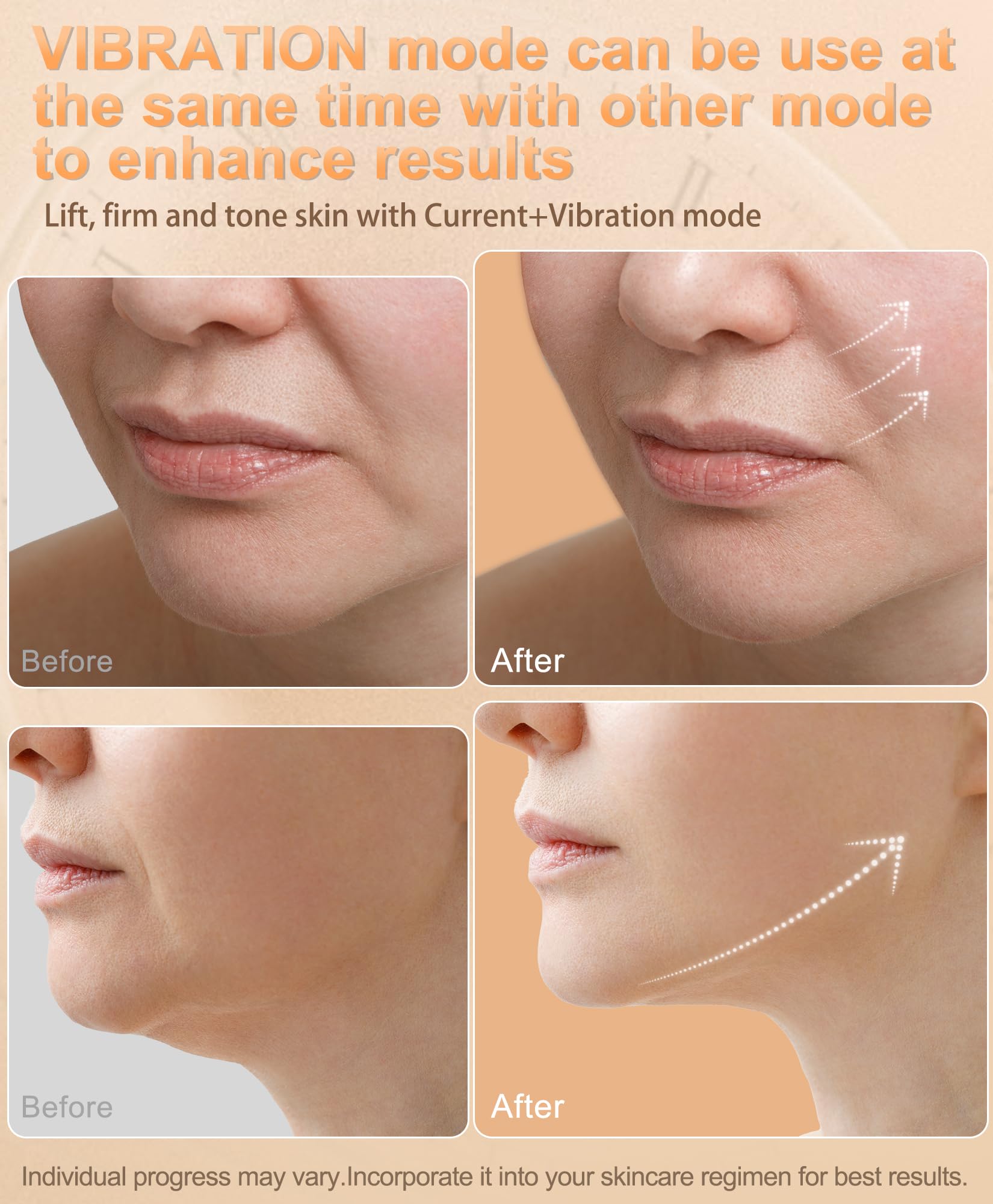 Generic Nulift NL04 cooling mode close-up depicting pore tightening