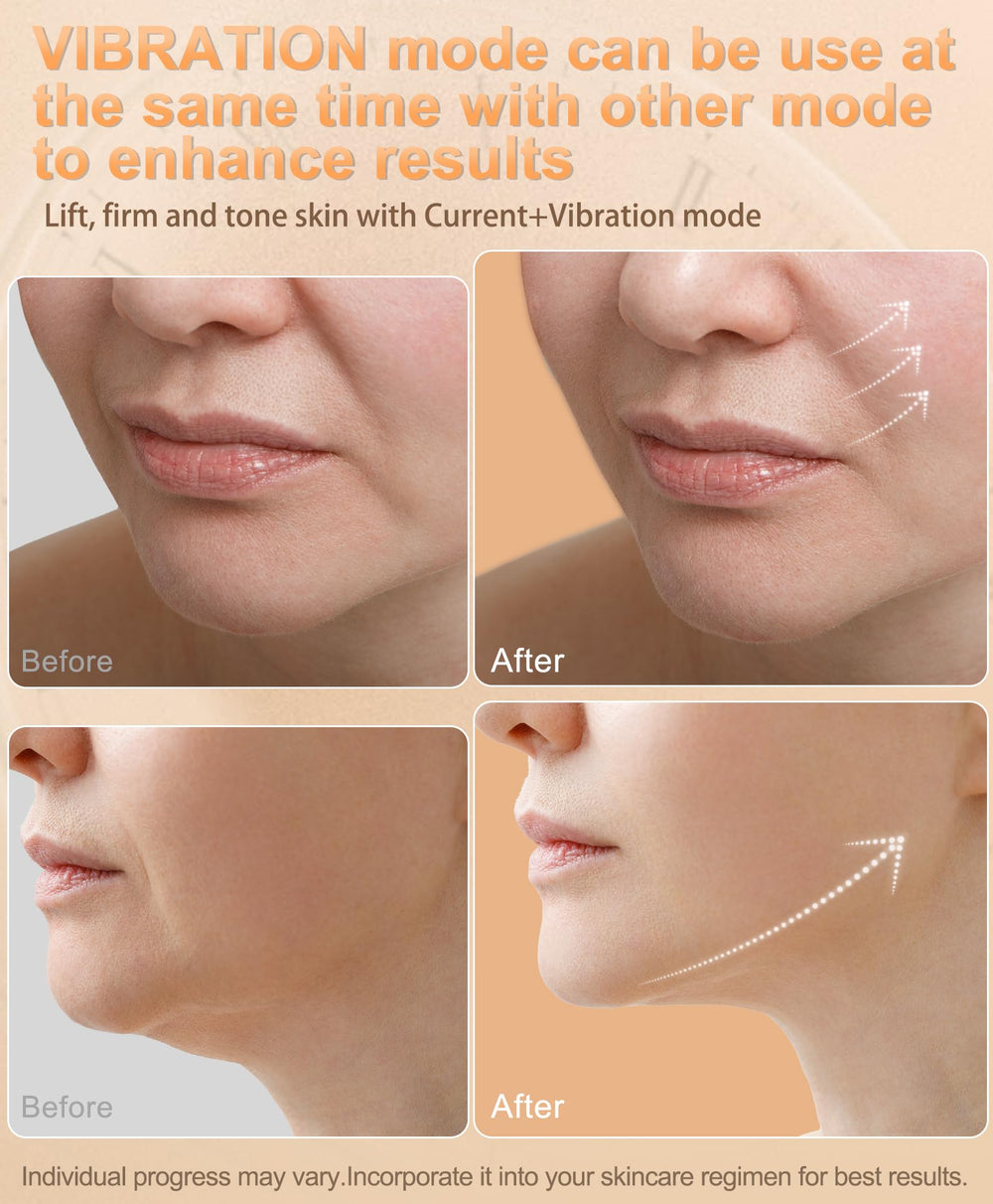 Generic Nulift NL04 cooling mode close-up depicting pore tightening