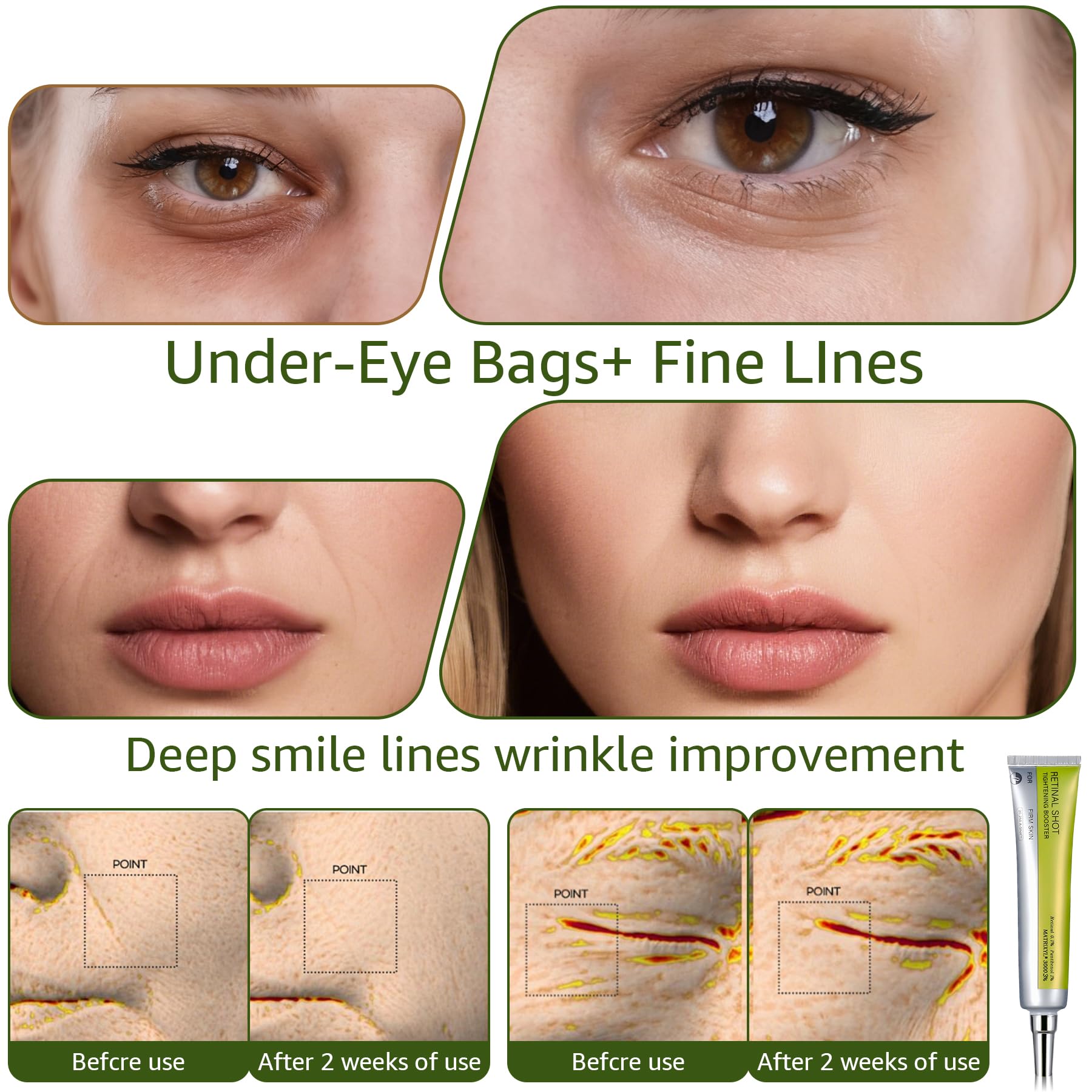Generic Retinal Shot Tightening Serum Swirl suggests smoother texture and even complexion.