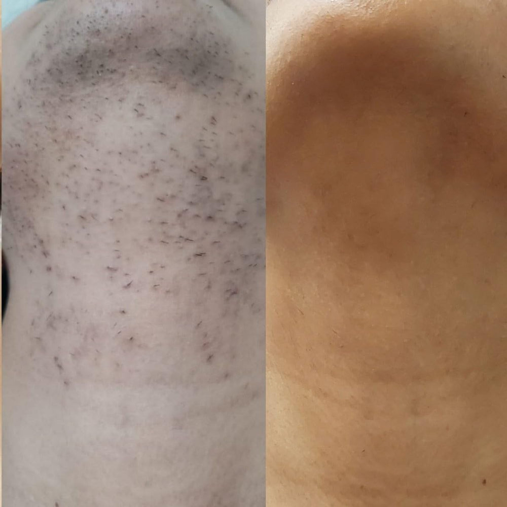 Generic Velare Cyperus Rotundus Oil shown against skin with a subtle glow.