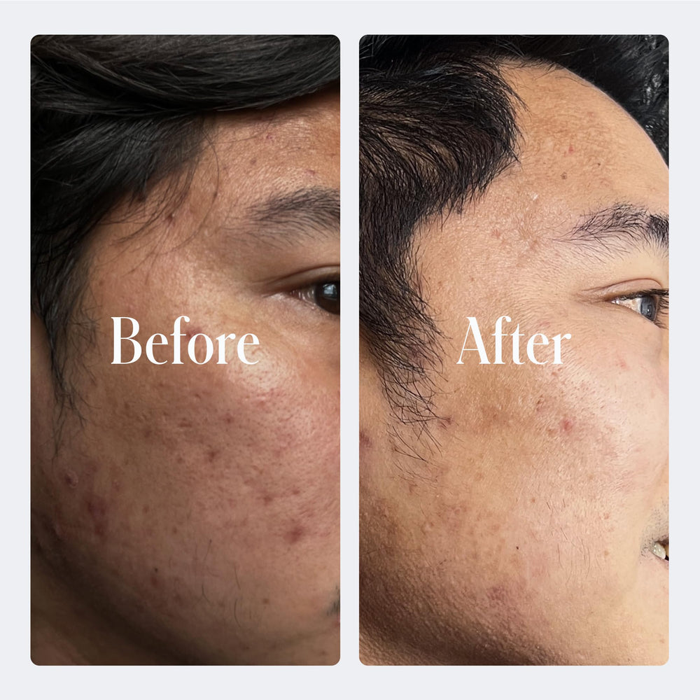 Geologie Retinol Night Cream spread on cheek demonstrates smooth absorption.