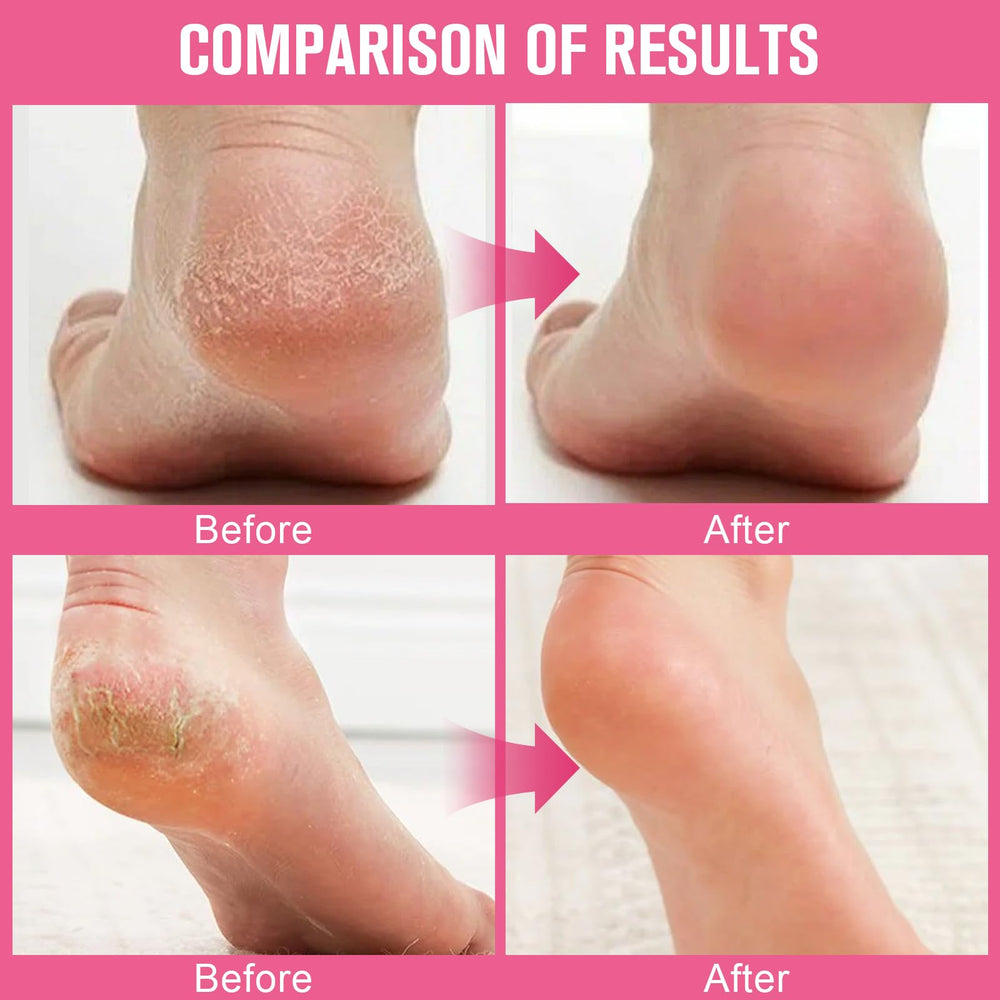 GHENGUA cream on heels and hands demonstrates multi-area care for dry skin.