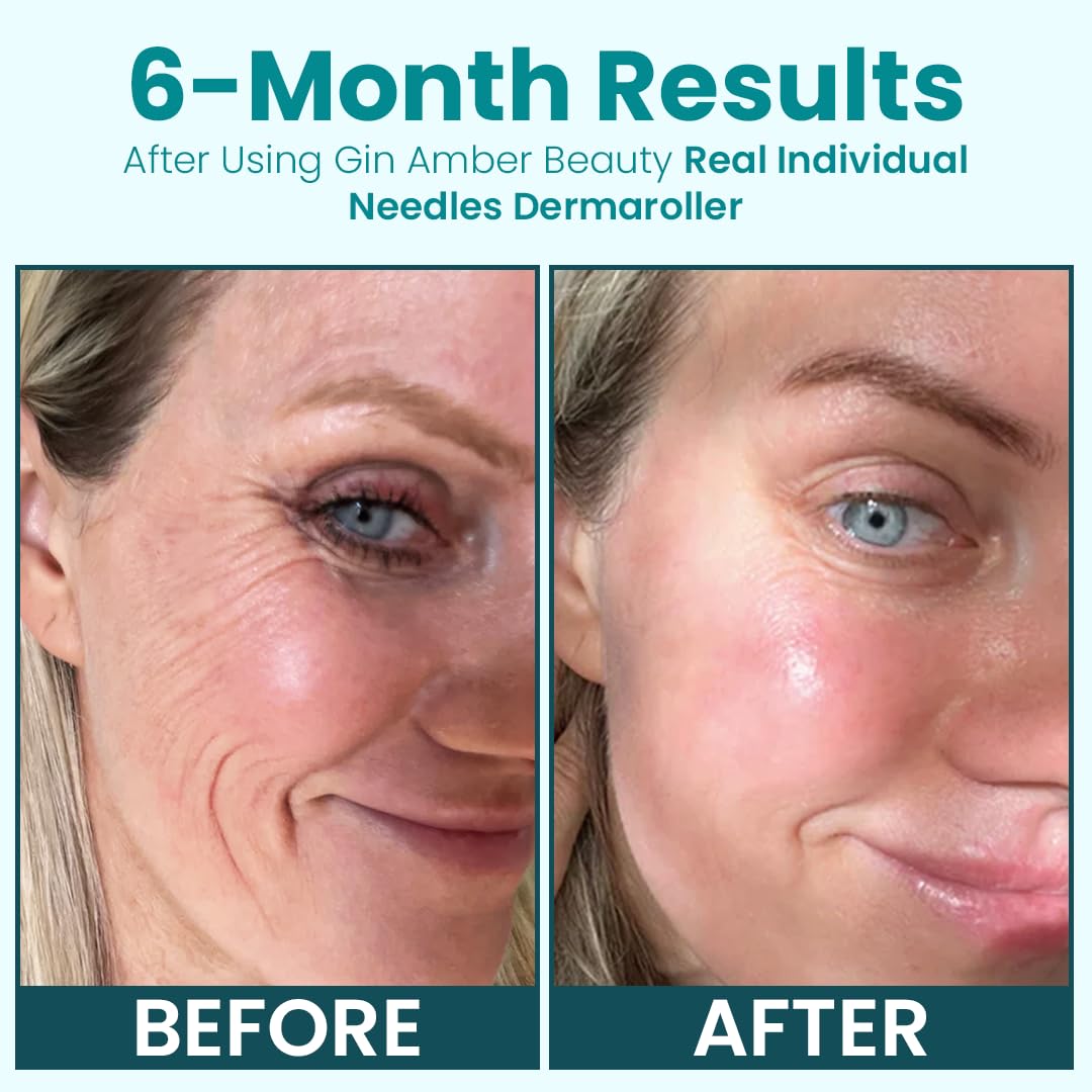 Gin Amber Beauty derma roller serum-friendly use supports even serum distribution.