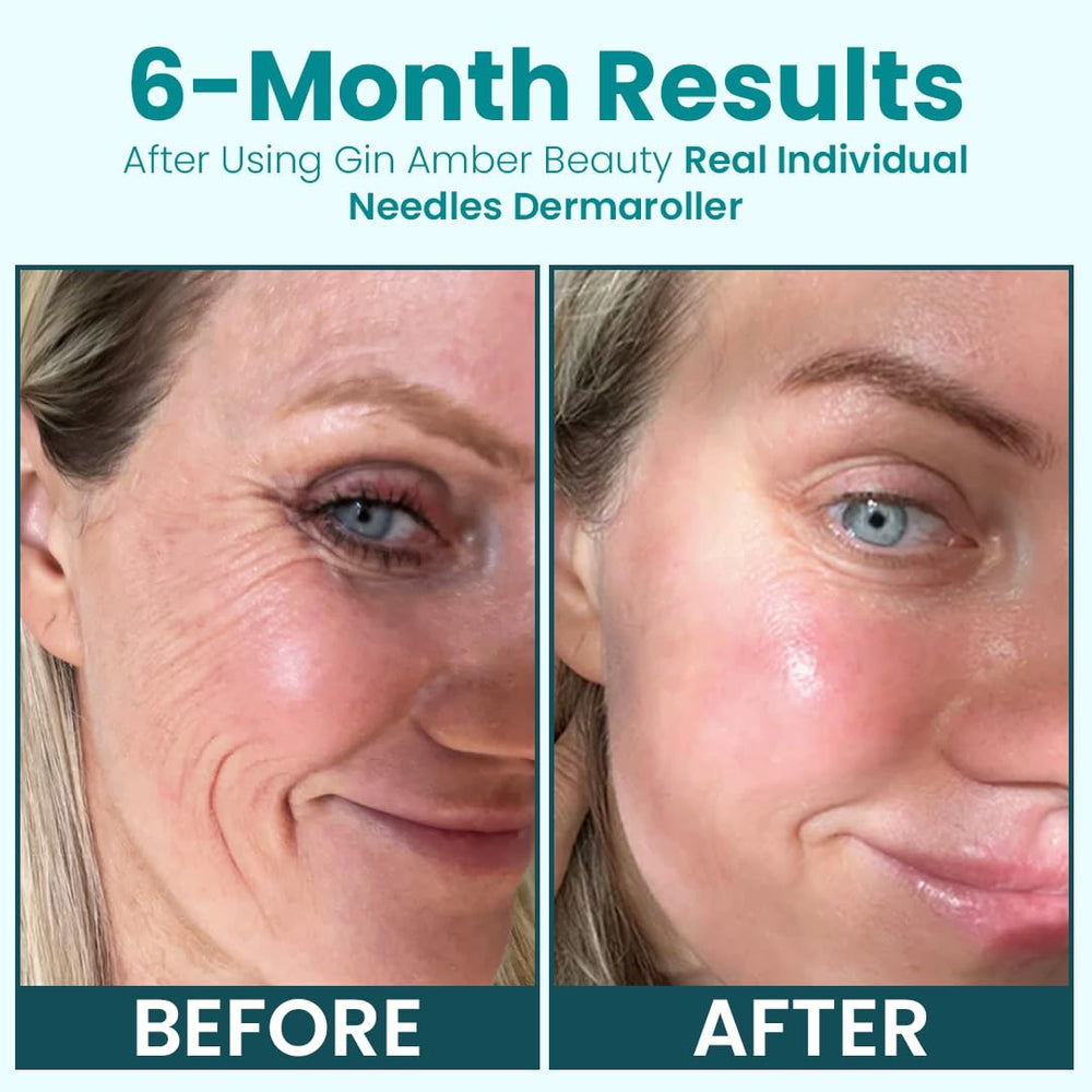 Gin Amber Beauty derma roller serum-friendly use supports even serum distribution.