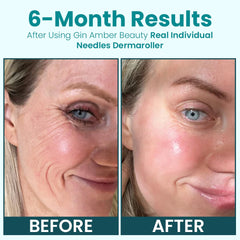 Gin Amber Beauty derma roller serum-friendly use supports even serum distribution.