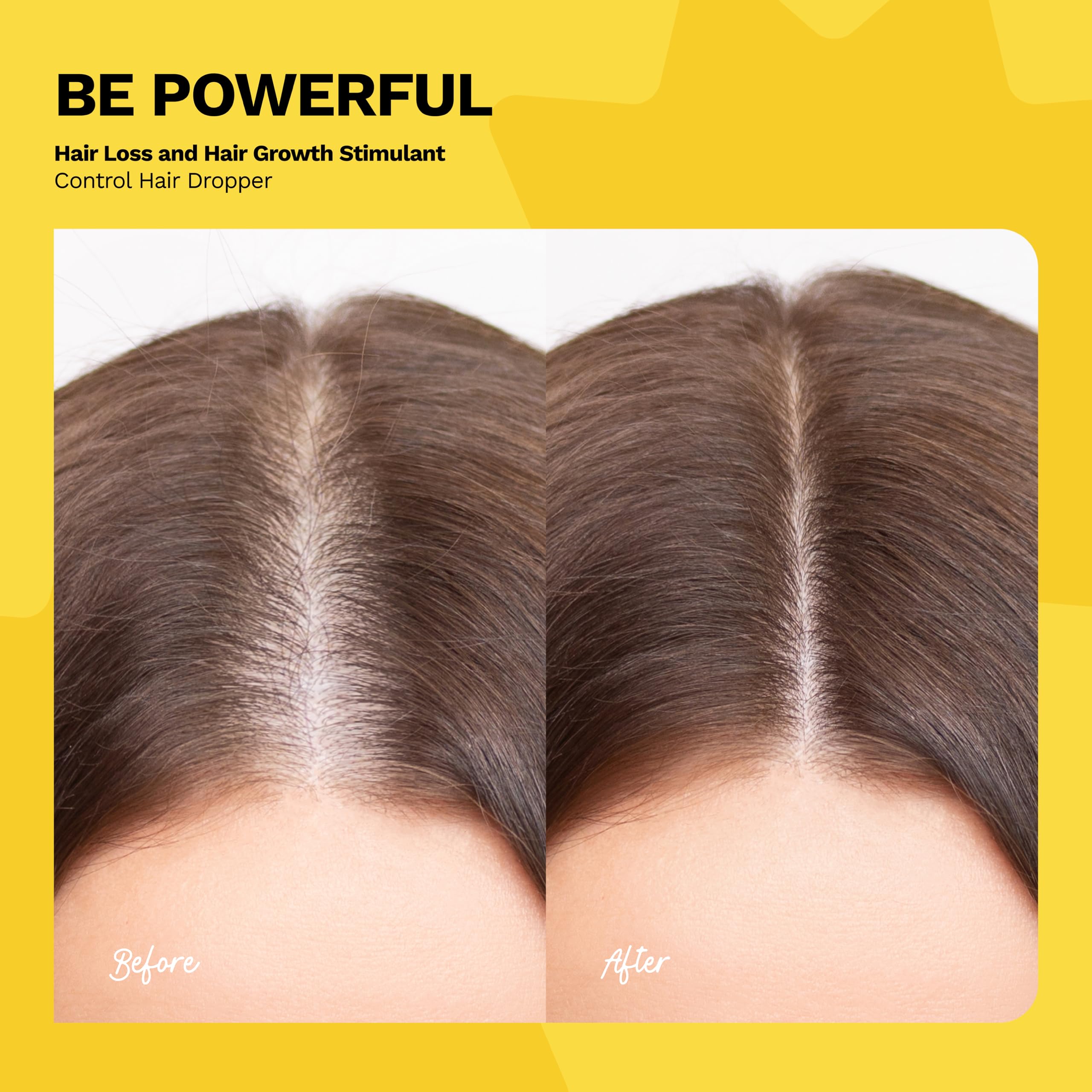 Ginger Milk Vitamin E nourishes the scalp and hair shaft.
