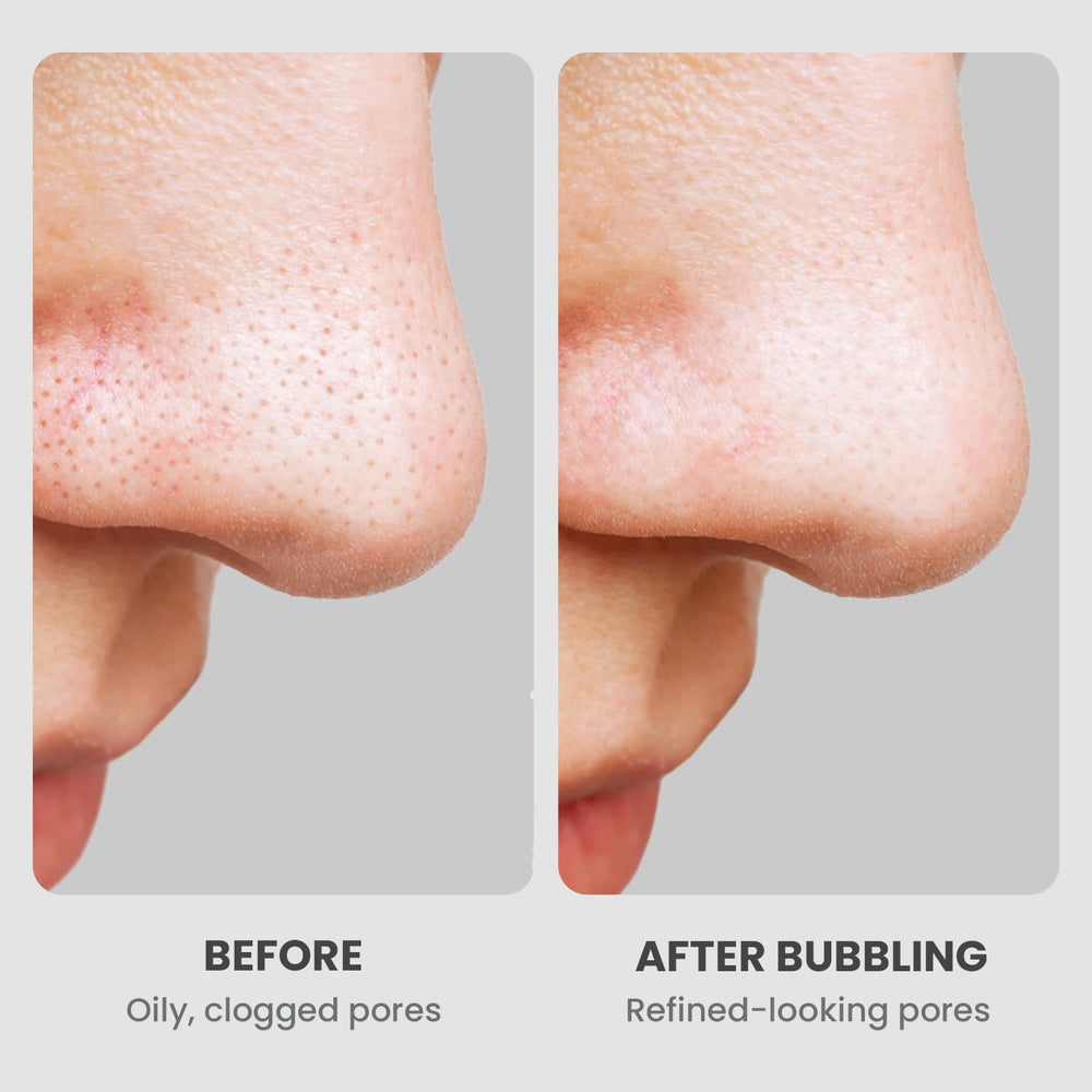GLAM UP Charcoal powder purifies without stripping skin