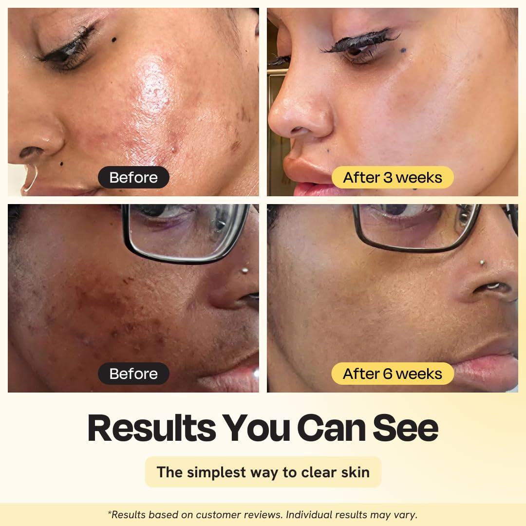 Gleamin creamy clay texture spread on skin for gentle pore refinement