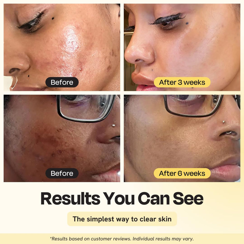 Gleamin creamy clay texture spread on skin for gentle pore refinement
