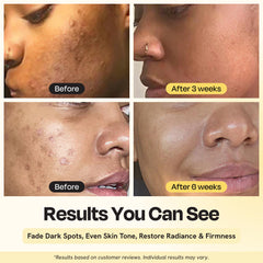 Gleamin Superactive Serum pump-dispense action enabling easy daily application