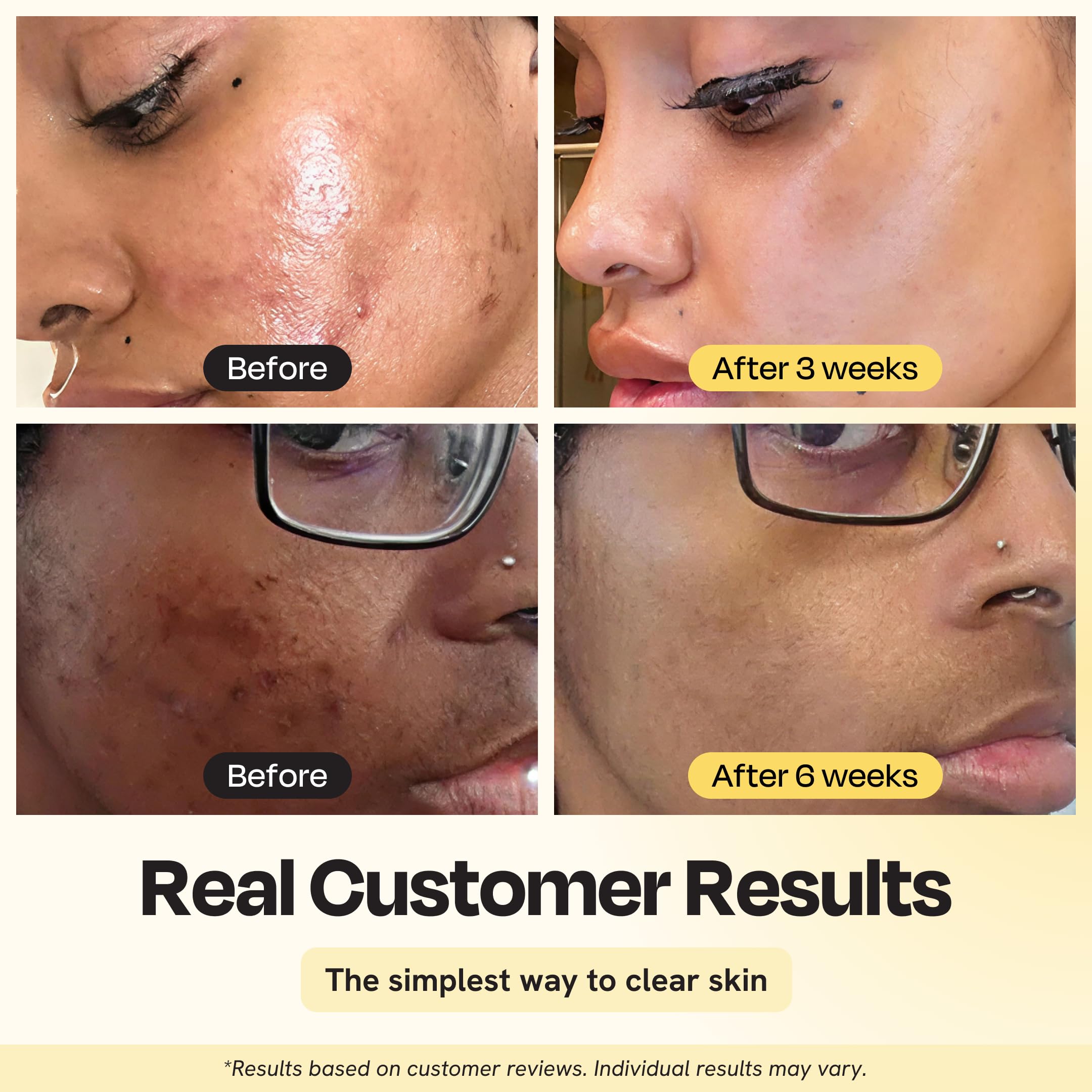 Gleamin Vitamin C Clay Mask with applicator brush for easy, even self-care application.