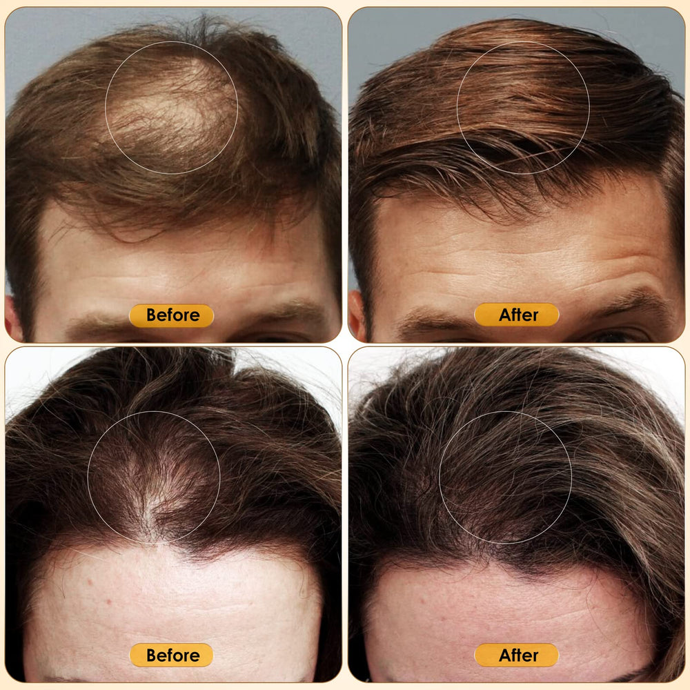 Glemme unisex usage with models demonstrates inclusive hair care potential.