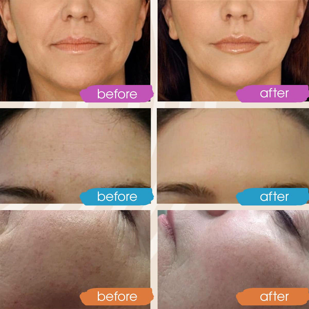 GLEOW night serum with retinol and aloe helps soften the appearance of wrinkles.
