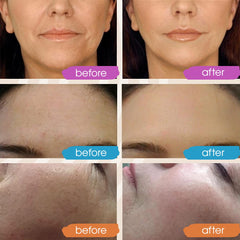 GLEOW Vitamin C Serum with hyaluronic acid emphasizes plump, hydrated texture.
