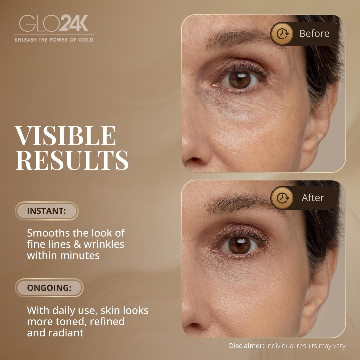 GLO24K application areas face close-up showing targeted areas for contour.