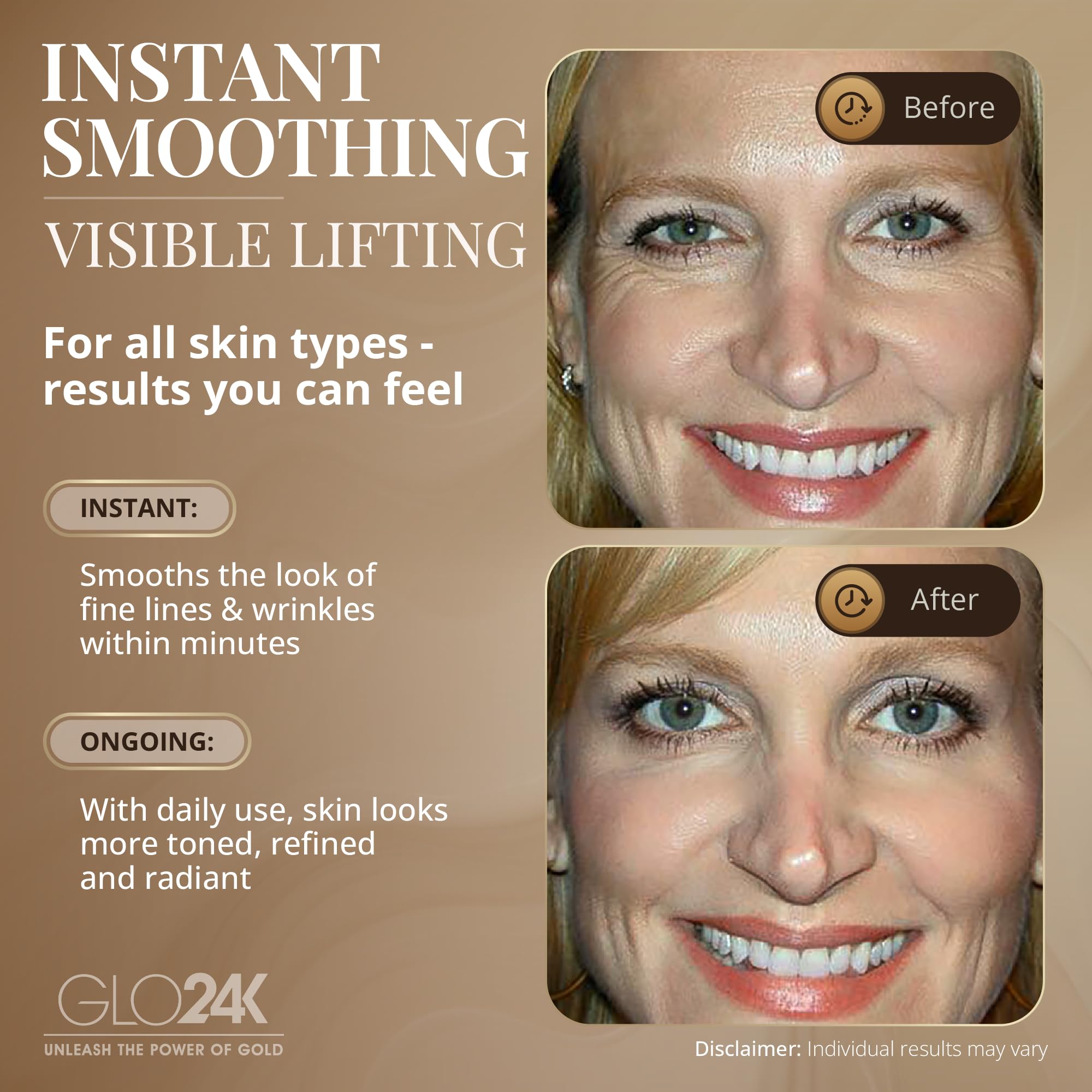 GLO24K no-needle applicator applying product around eye area