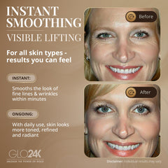 GLO24K no-needle applicator applying product around eye area