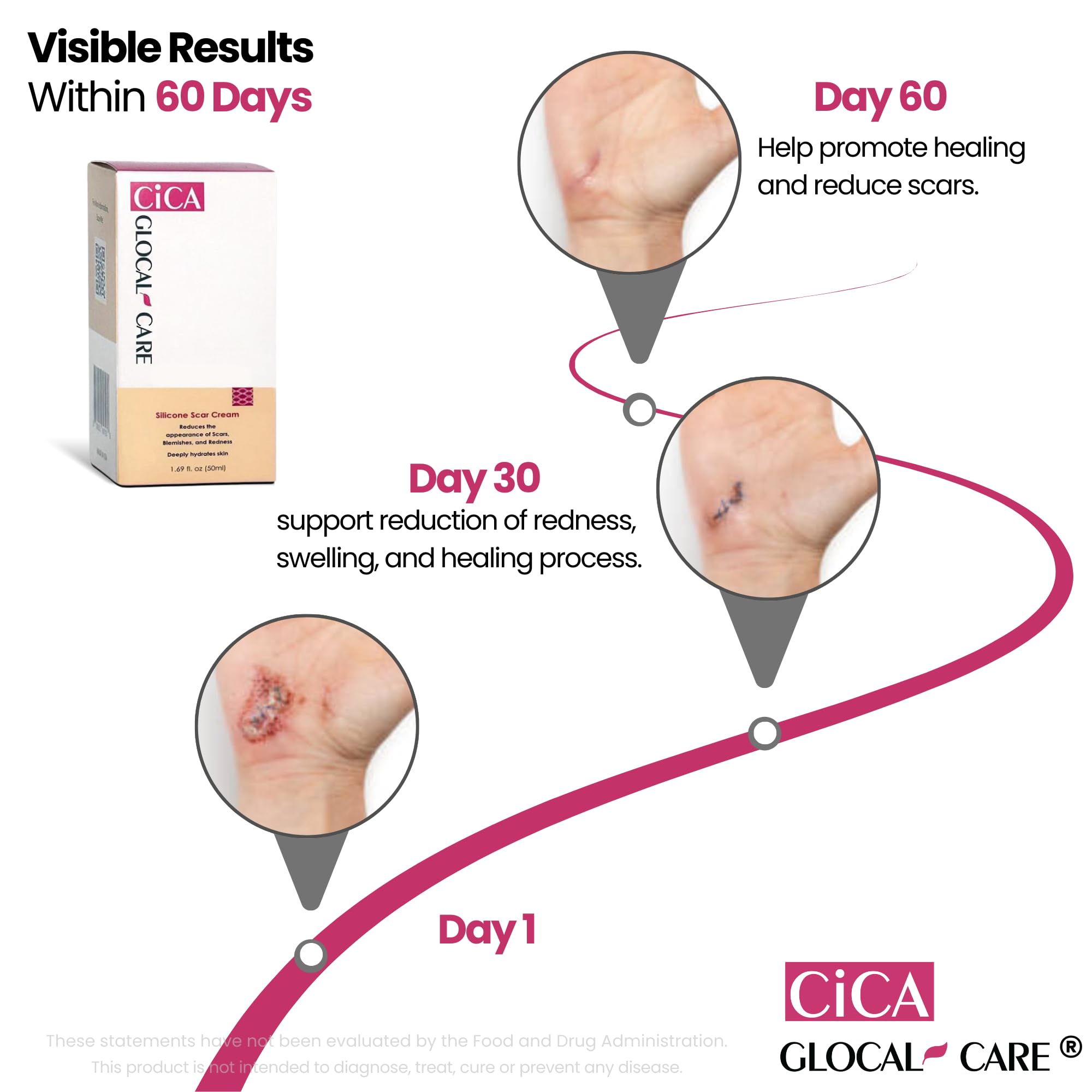 Hyaluronic acid hydrates the skin in GlocalCare CICA scar cream