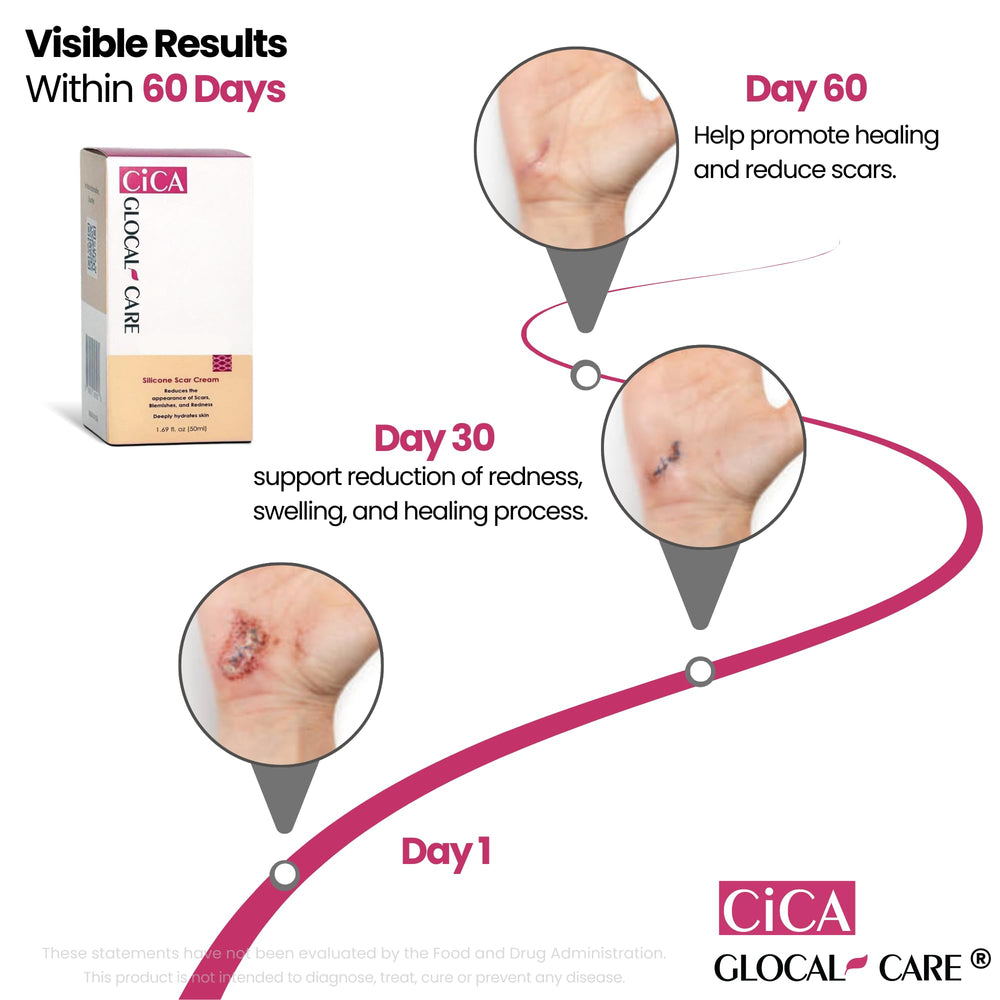 Hyaluronic acid hydrates the skin in GlocalCare CICA scar cream