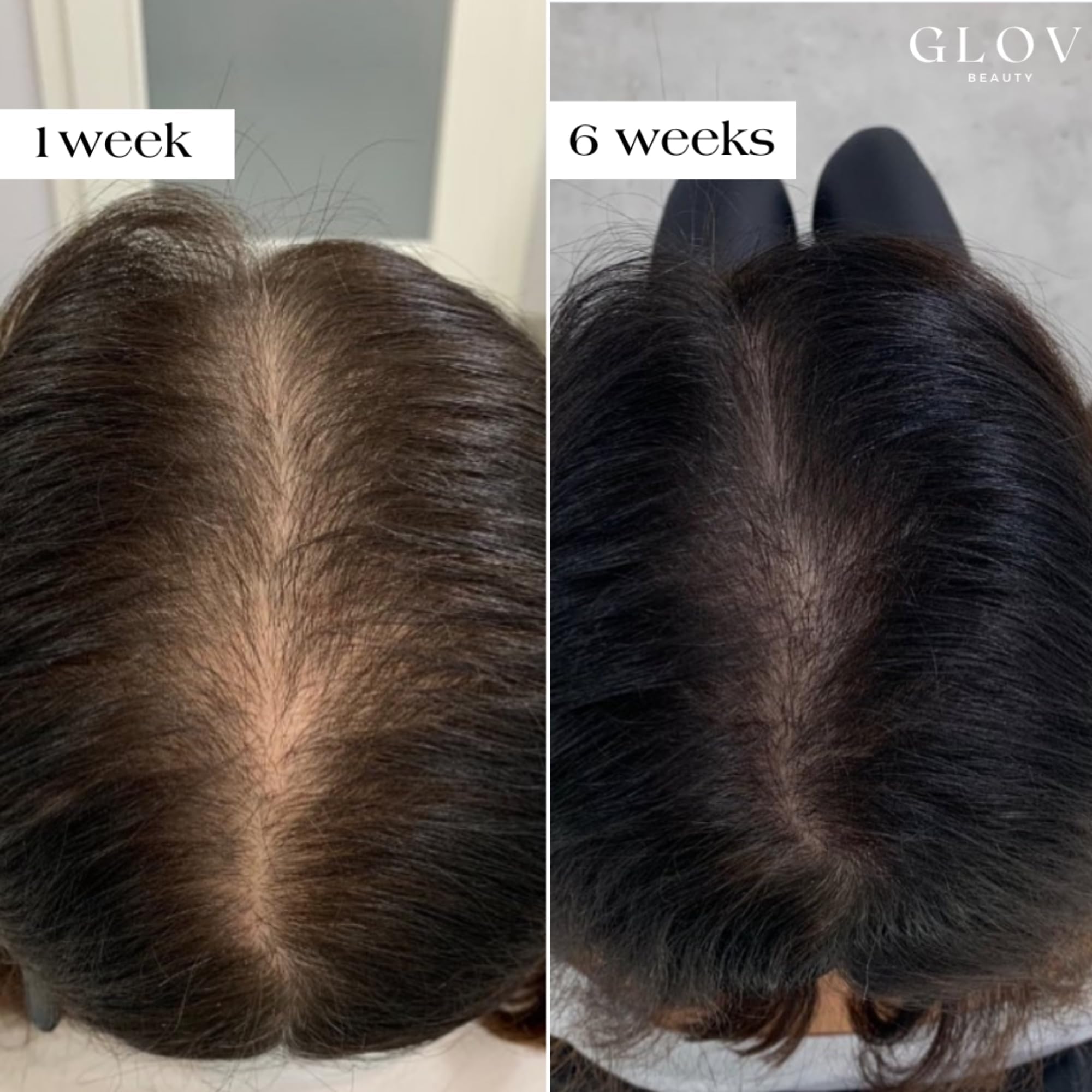 Glov Beauty botanical extracts soothe and invigorate the scalp.