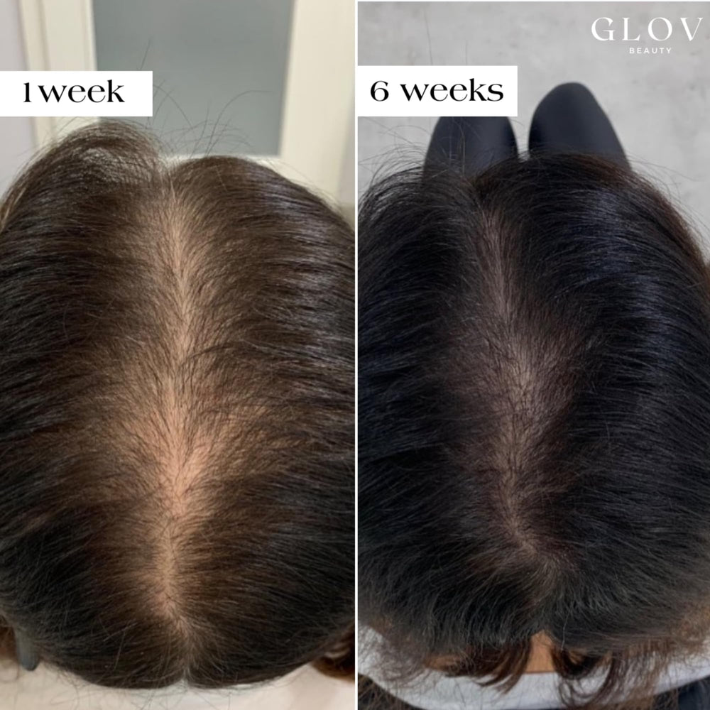 Glov Beauty botanical extracts soothe and invigorate the scalp.