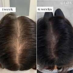 Glov Beauty botanical extracts soothe and invigorate the scalp.