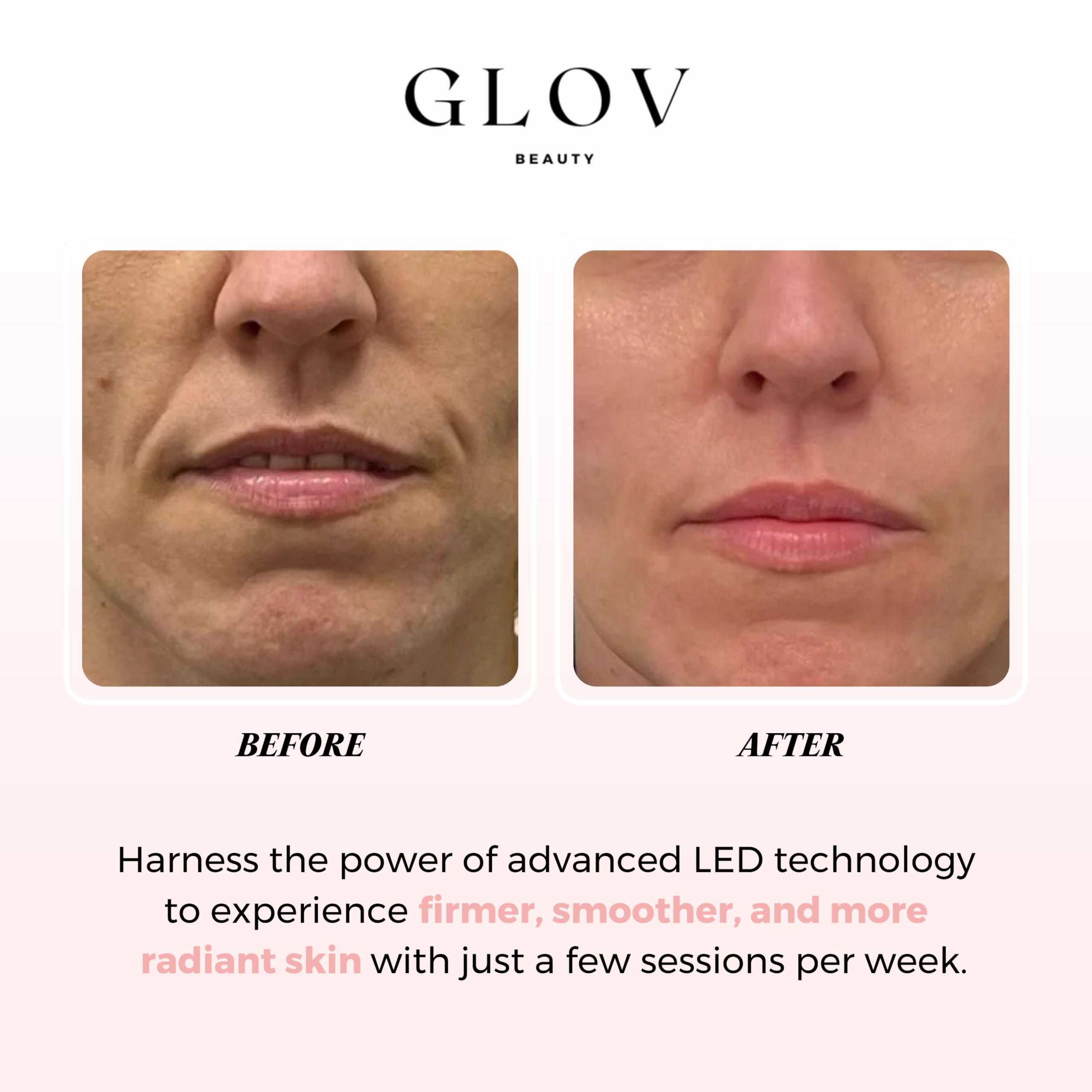 Glov Beauty LED mask remote control for easy session timing.
