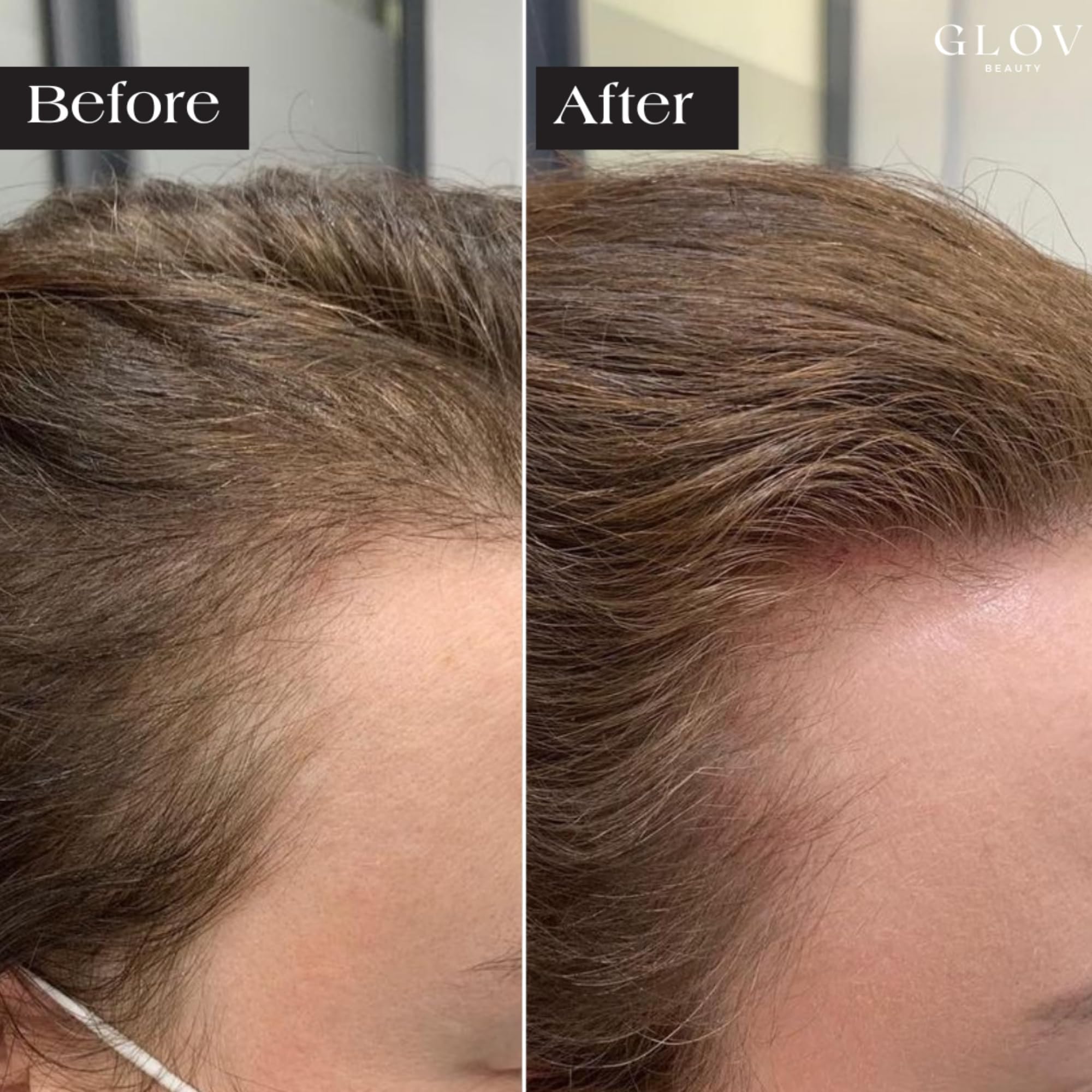 Glov Beauty single-use stamp head delivers clean precision.