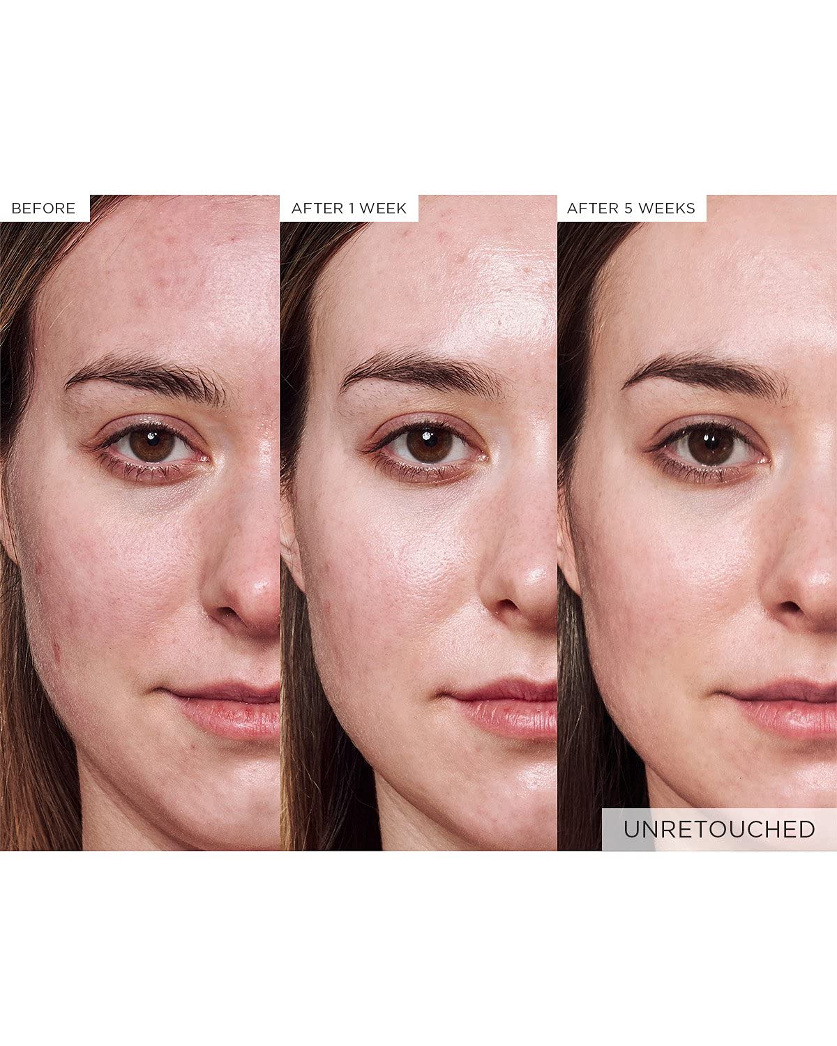 Barrier support concept with Glow Recipe Avocado Ceramide Serum