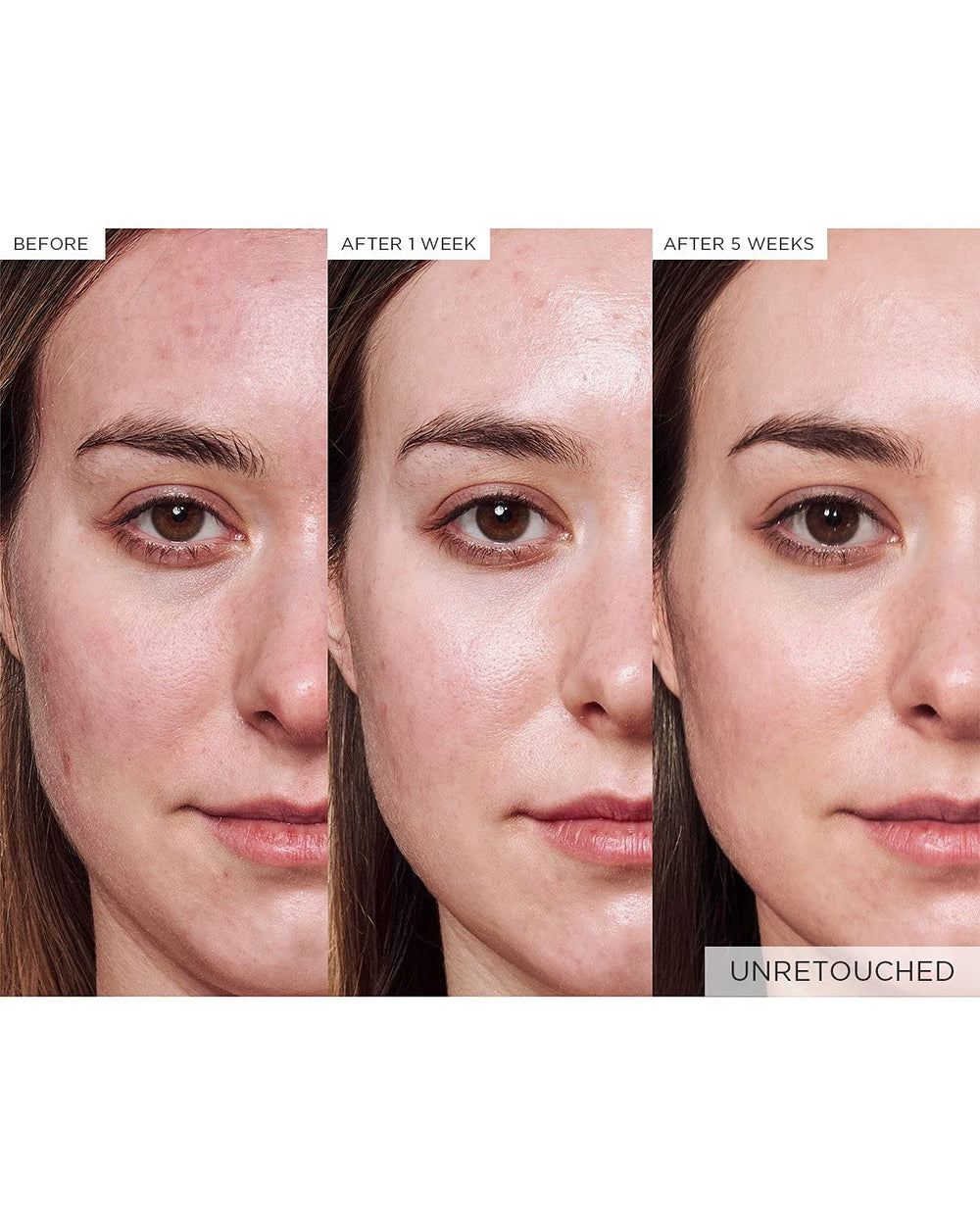 Barrier support concept with Glow Recipe Avocado Ceramide Serum