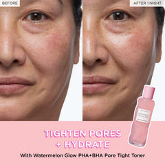 Glow Recipe Fruit Babies Hyaluronic Acid Cream close-up; lightweight hydration for plump skin