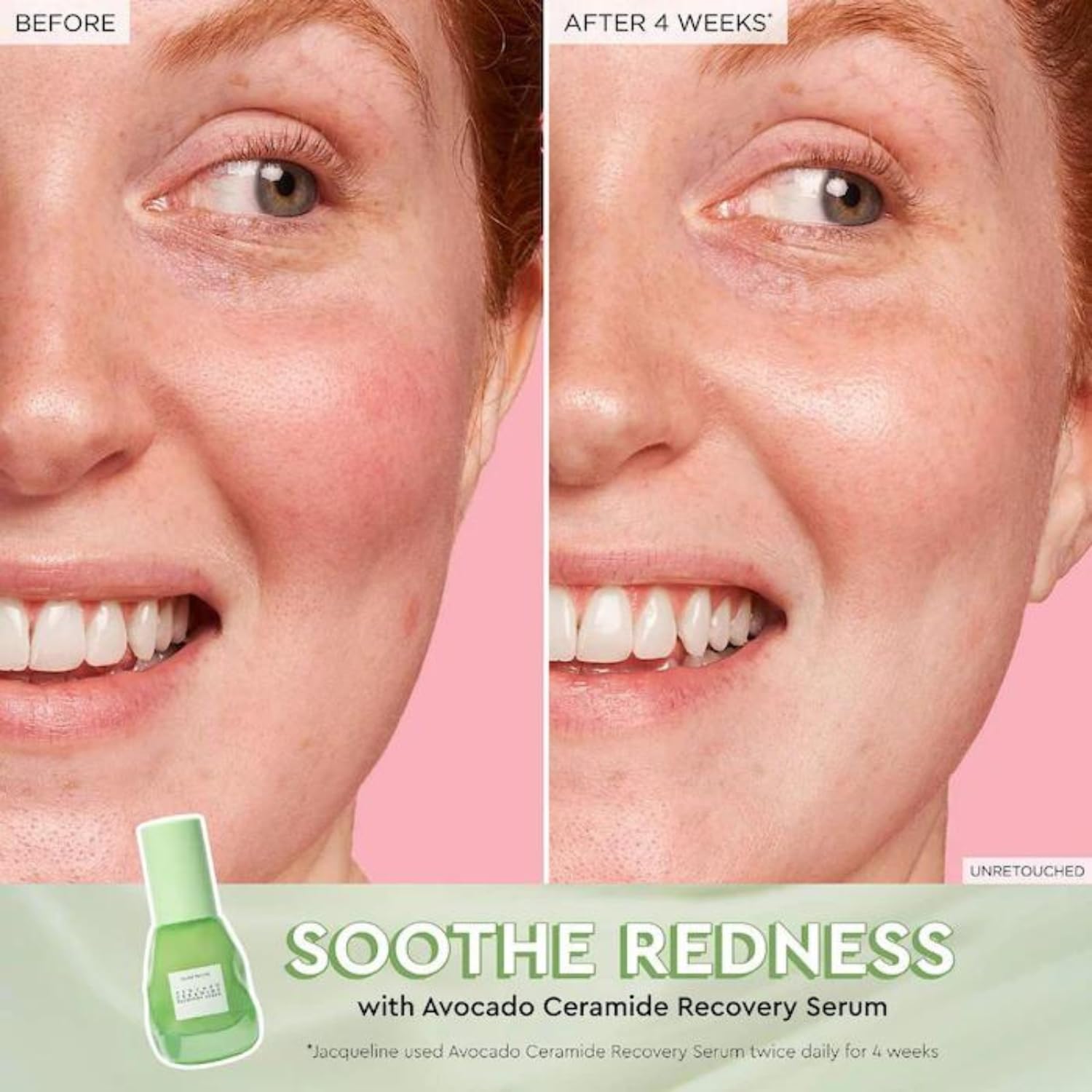 Glow Recipe Niacinamide Dew Drops application texture showing instant glow.