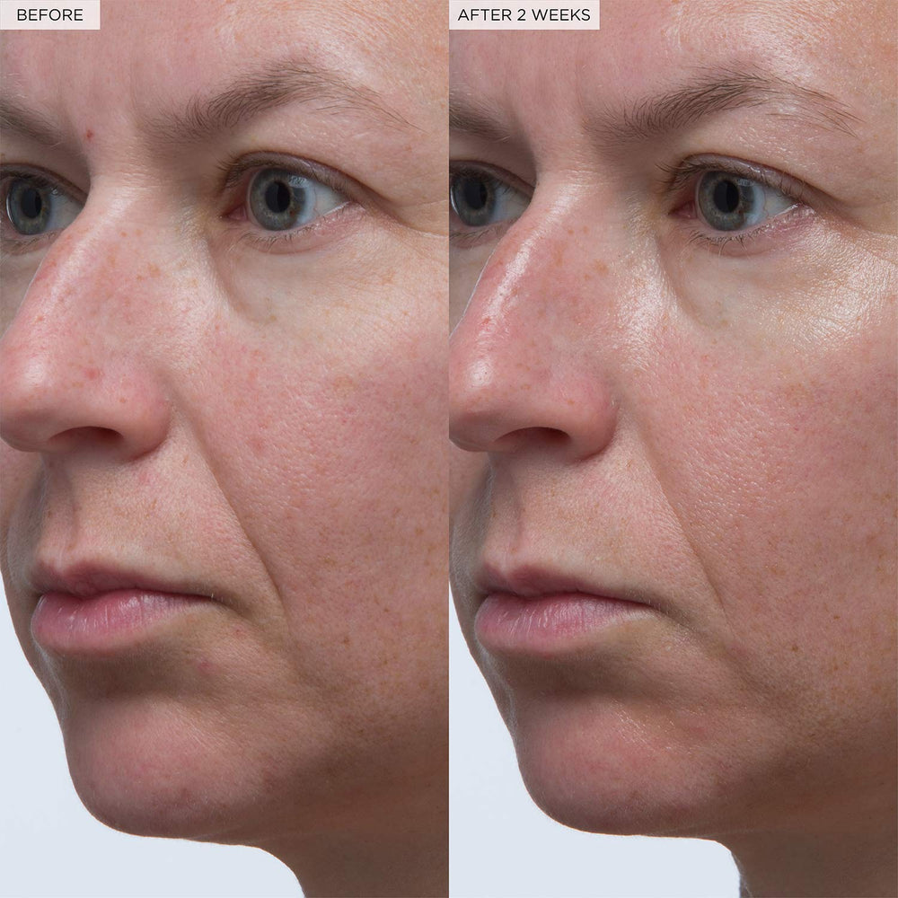 Hydration boost results in smoother skin texture
