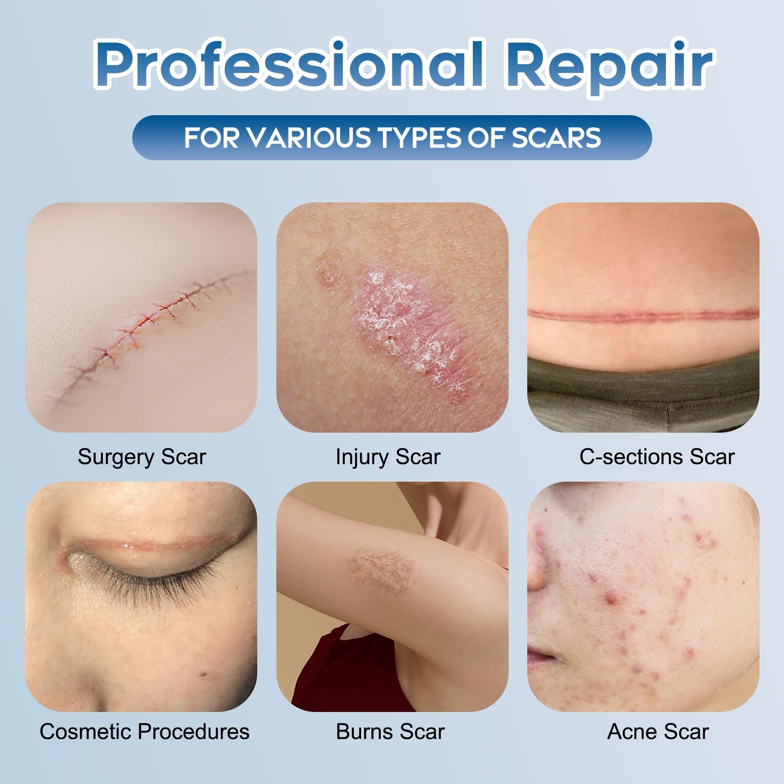 Glowor gel texture close-up shows quick-absorbing scar care