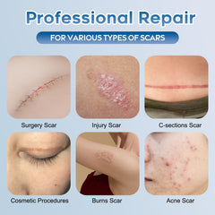 Glowor gel texture close-up shows quick-absorbing scar care
