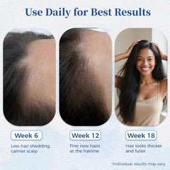 Gluvelessia pea-extract formula nourishes the scalp for daily use.