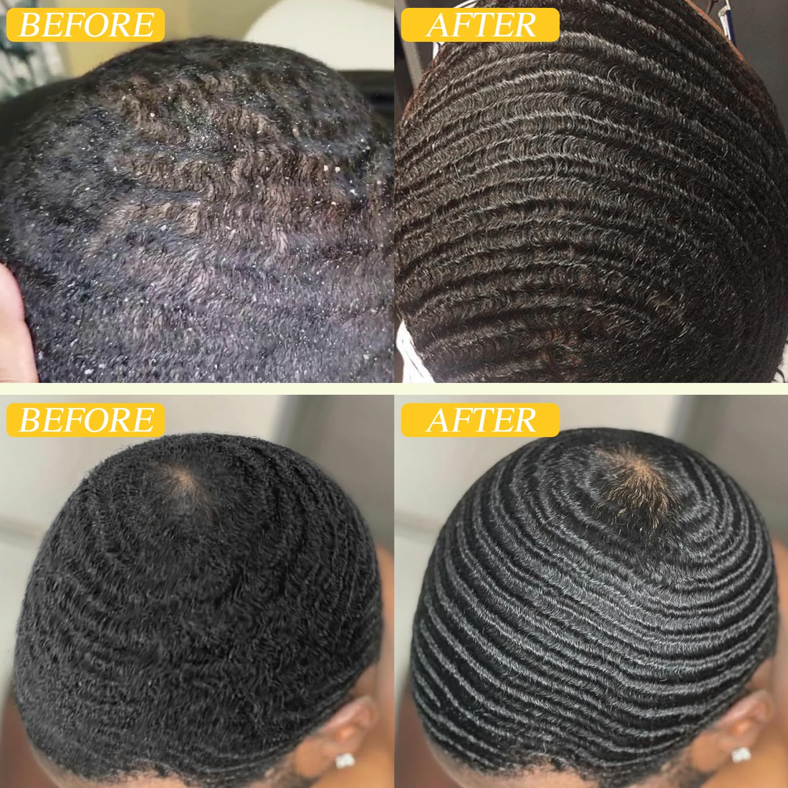 Goiple rosemary and tea tree scalp refresh shown during cleansing.