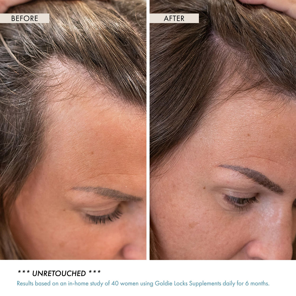 Goldie Locks adaptogenic herbs visual for stress-balanced routines.