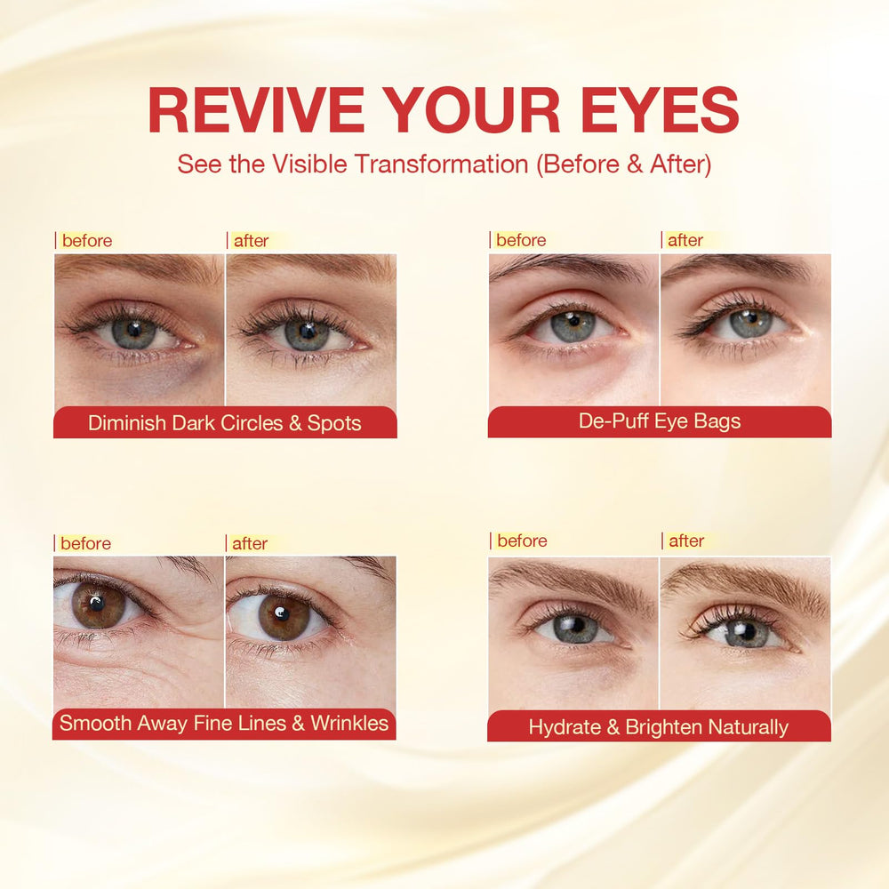 GONIM salmon DNA PDRN eye patches support skin resilience and repair.